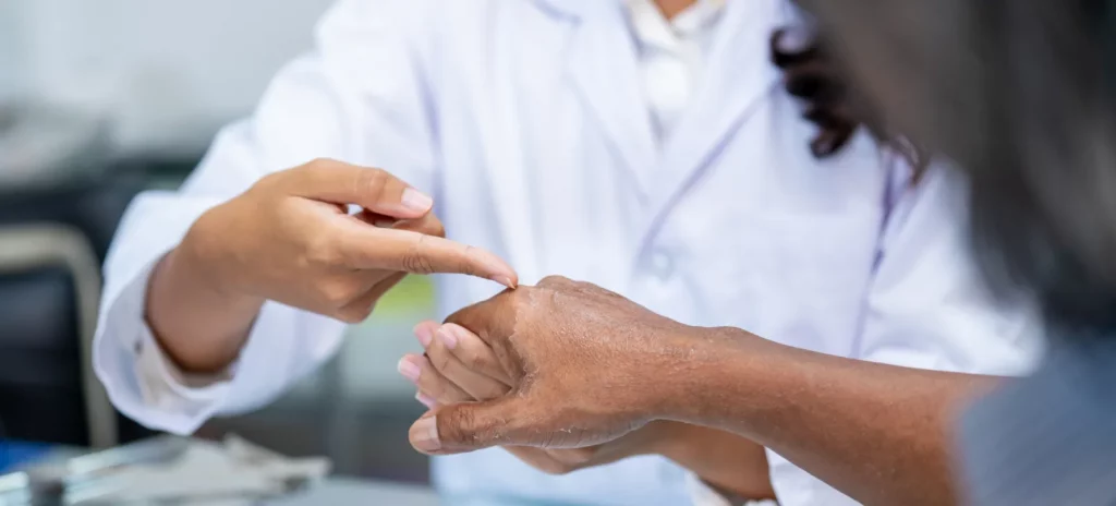 Een dokter onderzoekt de hand van een patient met psoriasis
